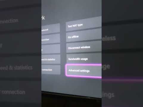 Fix xbox lag with this simple trick #xbox #shorts #viral